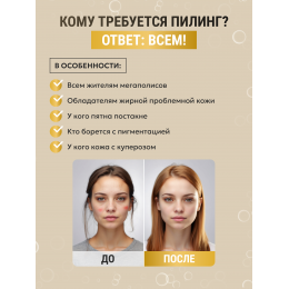Пилинг №4  Миндальный с арбутином 15 мл