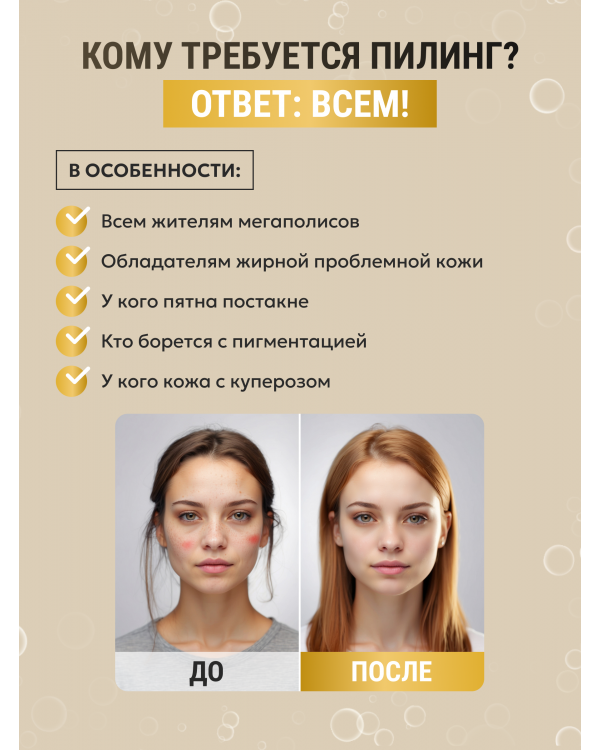 Пилинг №4  Миндальный с арбутином 15 мл